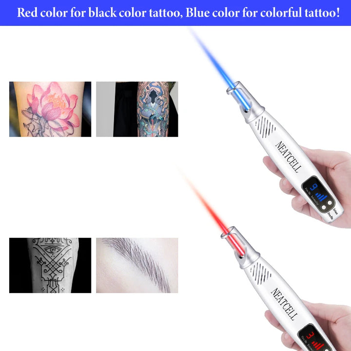 🌟 GlowLaser - Spot and Imperfection Removal Pen 🌟